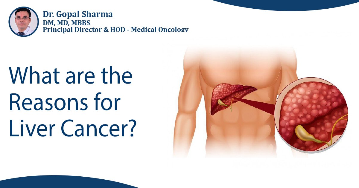 Breast cancer specialist in Delhi NCR