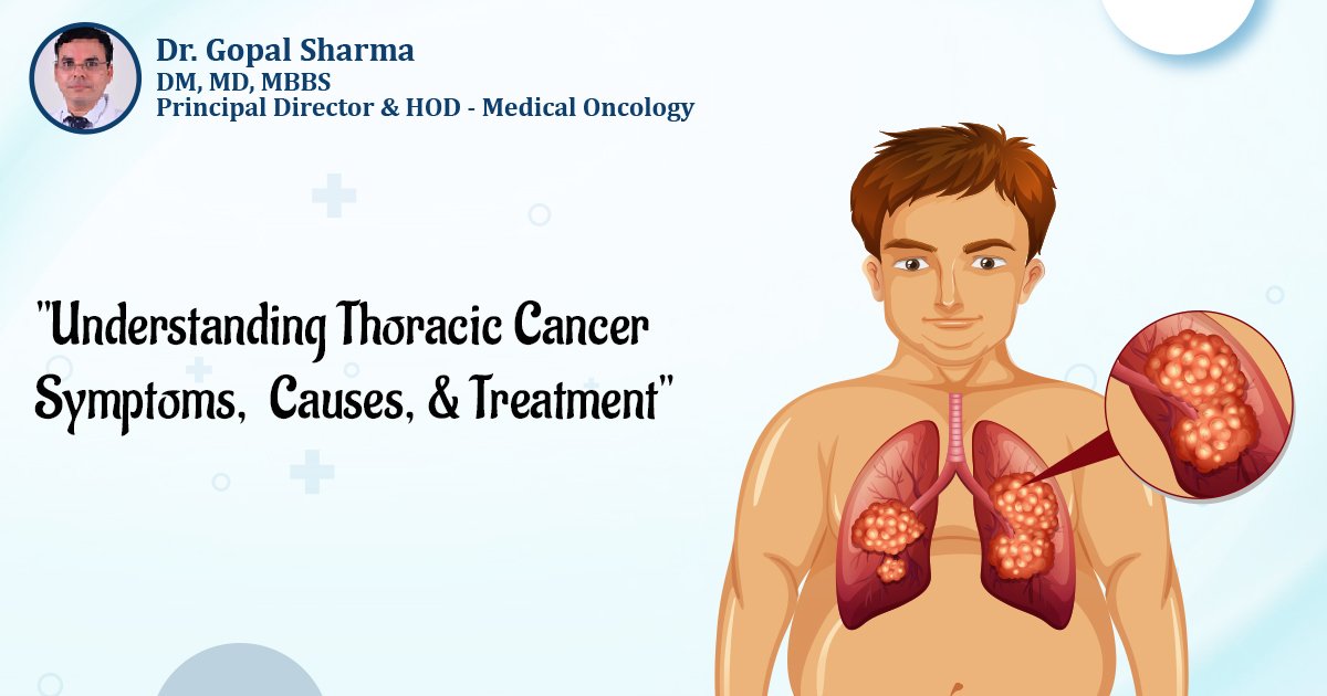 Thoracic Cancer Treatment in Delhi