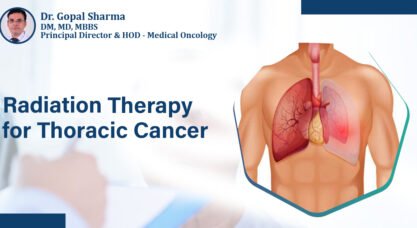 Radiation Therapy for Thoracic Cancer