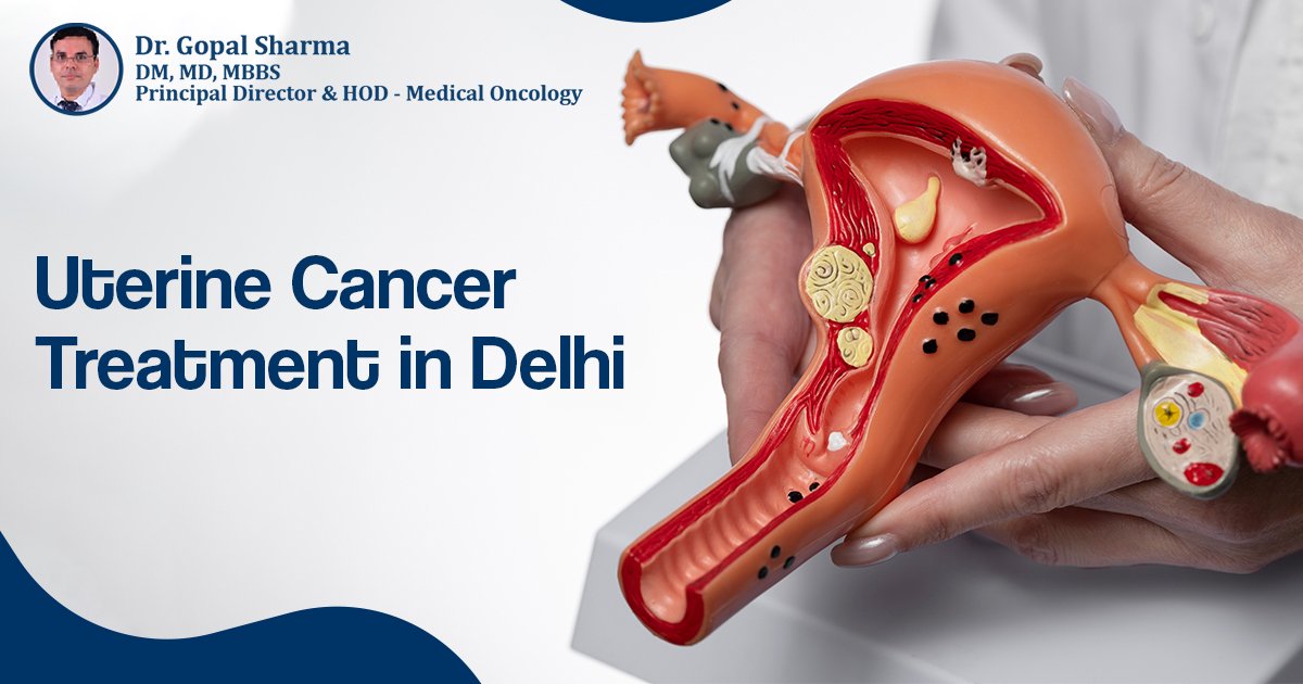 Uterine Cancer Treatment in Delhi