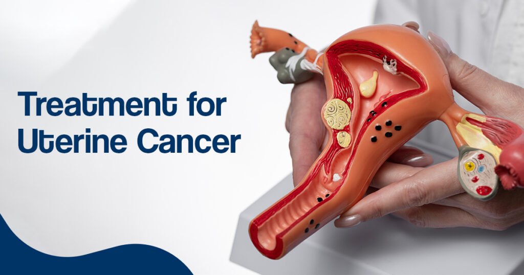 Treatment for Uterine Cancer