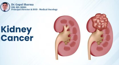 Kidney Cancer Treatment in Delhi