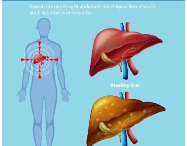 Liver cancer occurs when malignant cells develop in the liver, interfering with its vital functions.